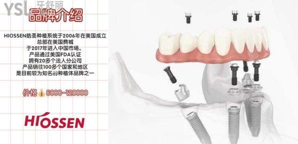 美國皓圣種植牙型號
