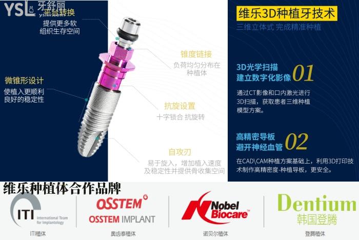 get新福州種植牙醫(yī)院排名！沒有BBQ只有哪家牙科醫(yī)院種植比較好！