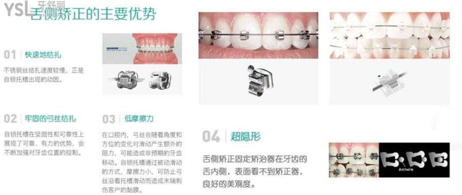 西安畫美團(tuán)圓口腔醫(yī)院價(jià)目表