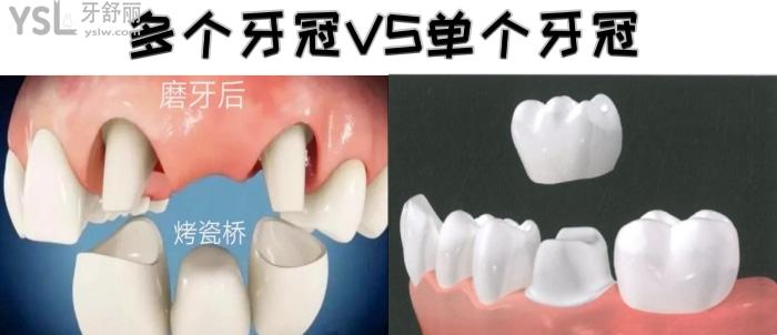 南京醫(yī)院可以做全瓷牙冠的有哪些？在南京烤瓷牙套一個(gè)多少錢呢？
