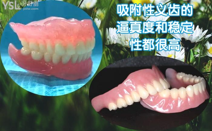 bps全口吸附性義齒價(jià)格多少錢？與普通活動(dòng)義齒的區(qū)別大嗎？