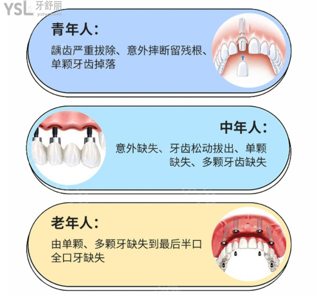 想知道在?？诜N全口牙需要多少錢？看完這份?？谘揽剖召M(fèi)價(jià)目表輕松了解！