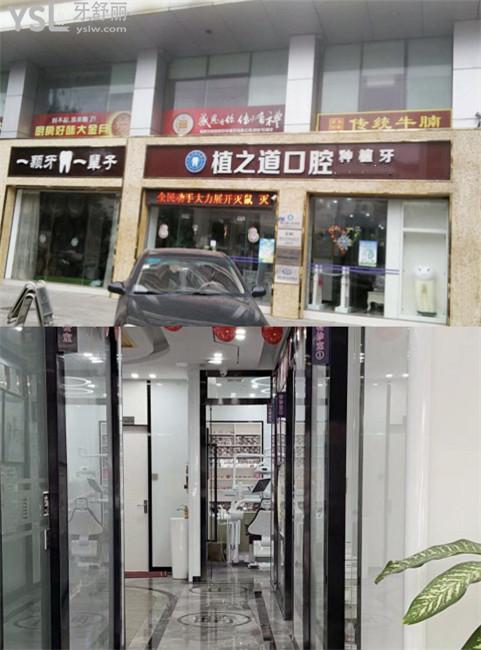 ?？谥仓揽谇环N牙怎么樣