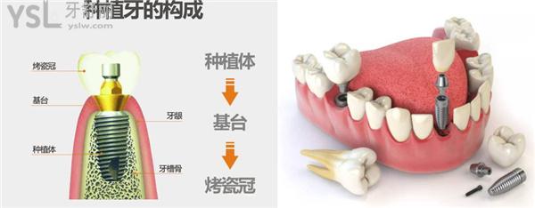 福清種植牙醫(yī)院排名