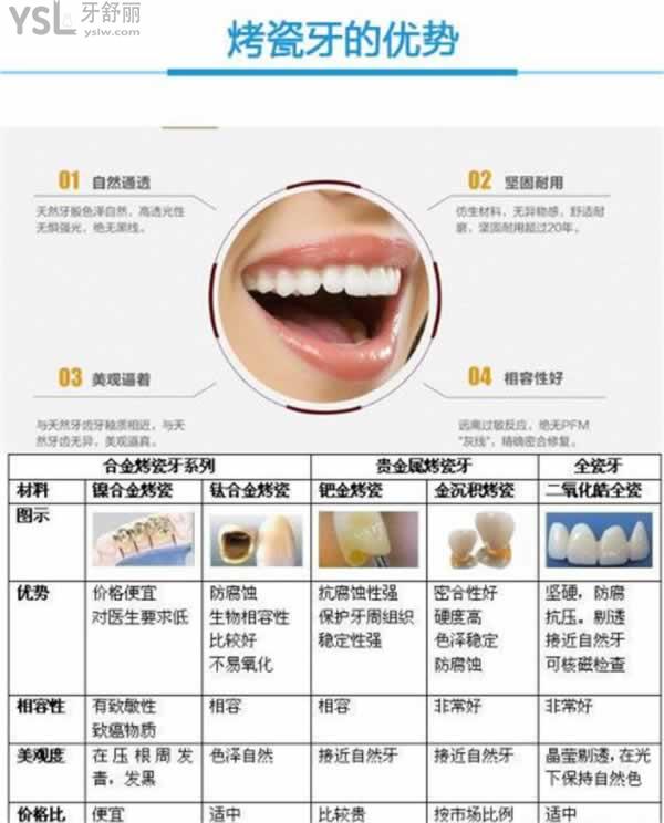 北京各口腔醫(yī)院鑲牙價格表，做烤/全瓷牙冠多少錢一顆