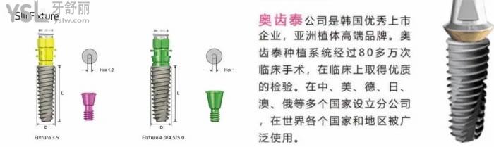 奧齒泰種植體型號大全