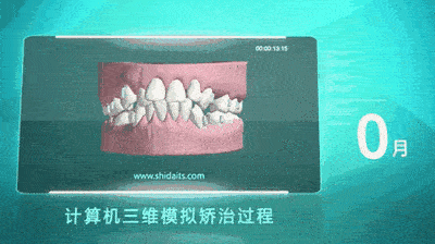 宜賓箍牙價(jià)格