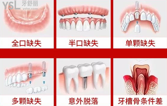 請(qǐng)把這條大數(shù)據(jù)推給缺牙的人，福州維樂(lè)口腔醫(yī)院幫助缺牙人士重拾口福！