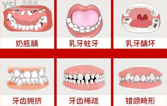 請(qǐng)把這條大數(shù)據(jù)推給缺牙的人，福州維樂(lè)口腔醫(yī)院幫助缺牙人士重拾口福！