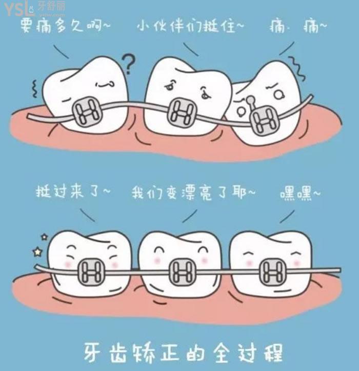 合肥整牙齒需要多少錢