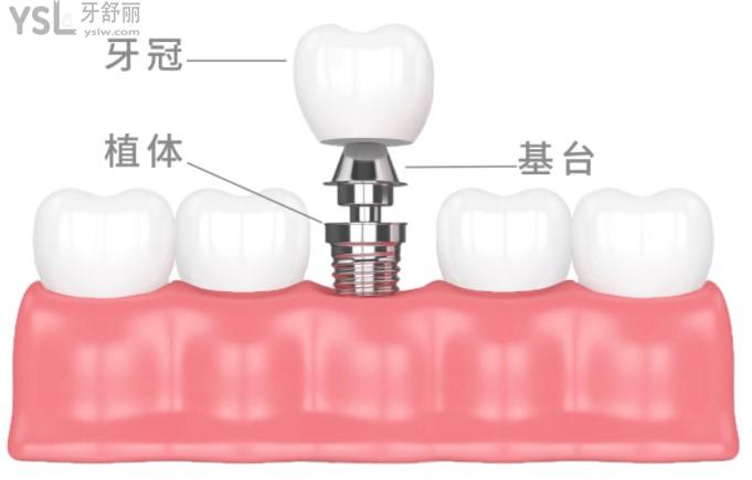 重慶美奧口腔6月活動