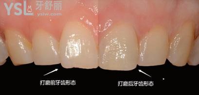 韓國有名的牙科醫(yī)院是哪家，韓國三小時牙科醫(yī)院