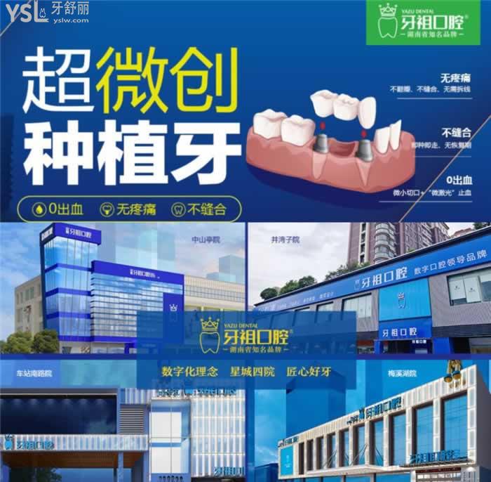 長(zhǎng)沙哪里種植牙便宜