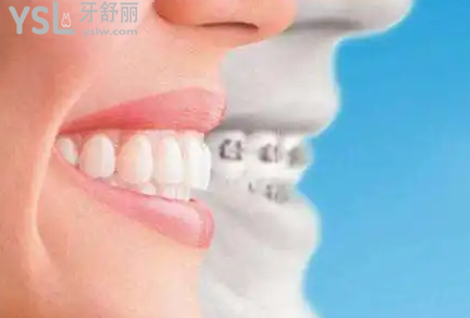 福建晉江金榜口腔醫(yī)院進(jìn)口隱形矯正立減10000元！