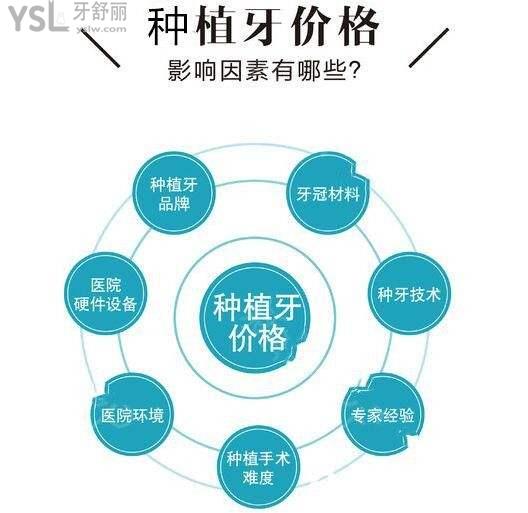 種植牙價(jià)格差別在哪里