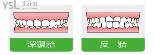 植得口腔活動