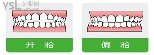 植得口腔活動