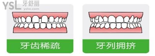 植得口腔活動