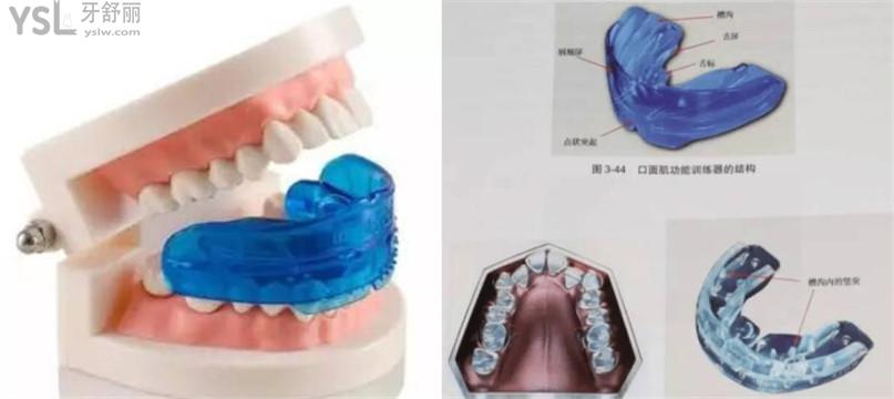 兒童MRC肌功能矯治器多少錢？?jī)和疢RC肌功能矯治器好嗎？