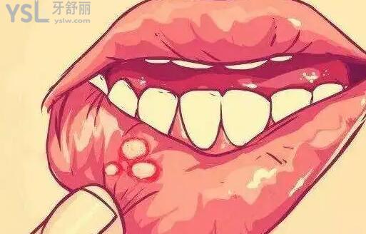 戴牙套后吃飯?zhí)墼趺崔k？這幾種牙疼方式你是否也中招了？.jpg