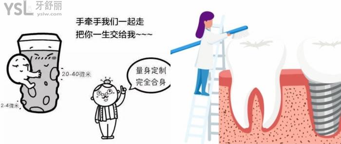 歐妮泰Basic種植體