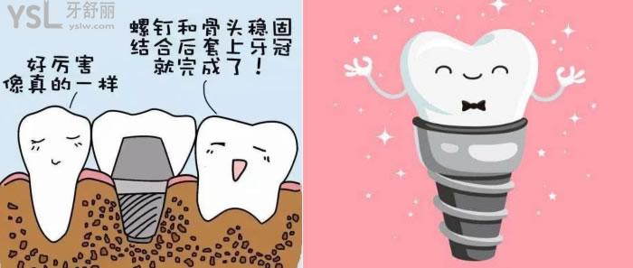 韓國奧齒泰種植體是純鈦的嗎