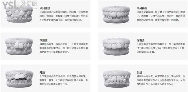 隱秀適合問題