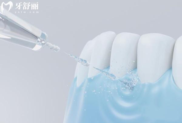 沖牙器沖水