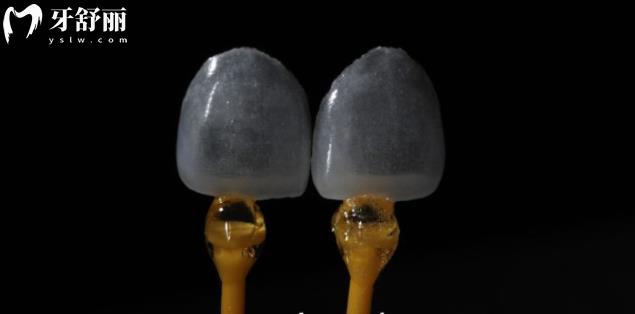 超薄牙貼面做完還能啃排骨嗎？吃貨們可要注意了