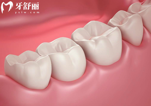 安聯(lián)種植牙是什么檔次的