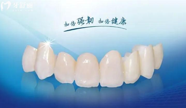 國(guó)產(chǎn)愛爾創(chuàng)全瓷牙
