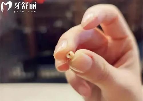 人的牙齒一般什么時候開始脫落完整的呢圖片分享
