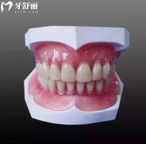 吸附性義齒多少錢