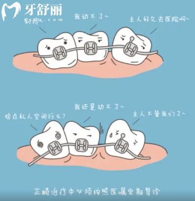 牙齒矯正會(huì)變牙套臉？帶牙套1~12月變化圖