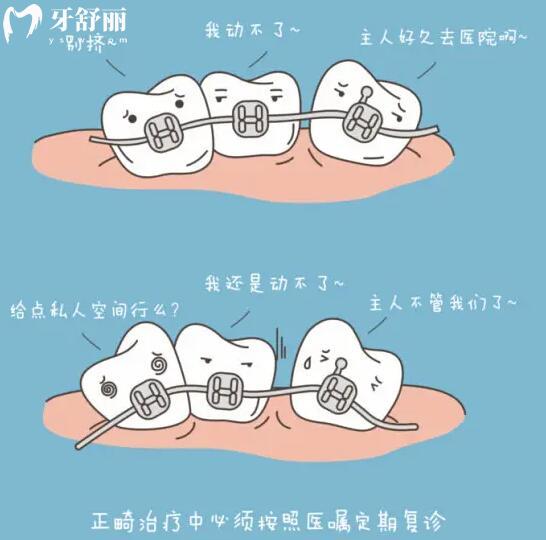 請(qǐng)問小孩牙齒矯正可以用隱適美牙套嗎？.jpg