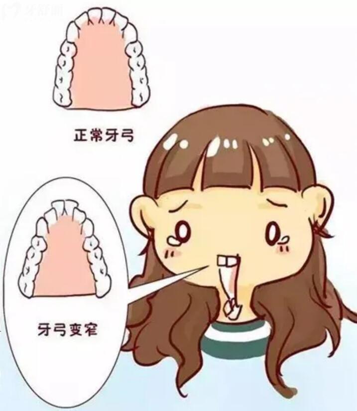 孩子有點齙牙需要矯正嗎？