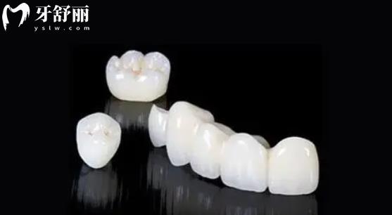 種植牙牙冠國(guó)產(chǎn)還是進(jìn)口的好 牙科中常用的牙冠品牌有哪些？