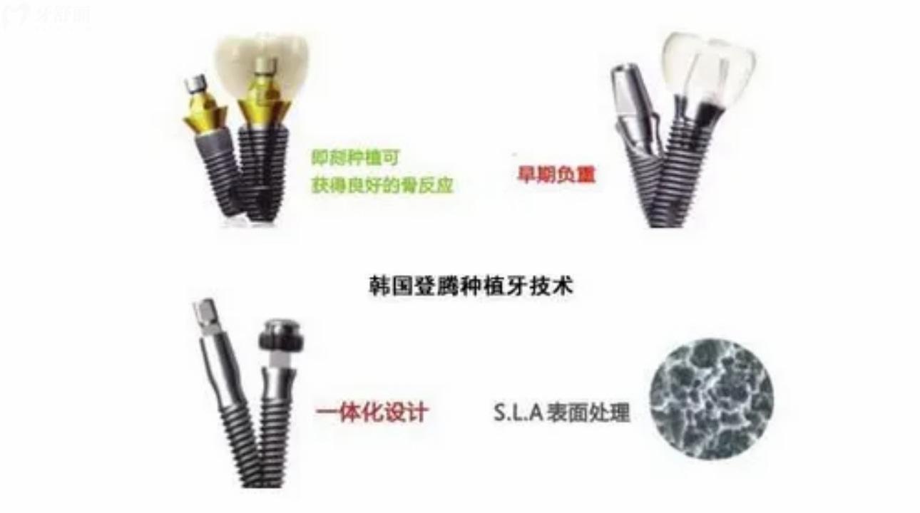 韓國登騰Dentium種植體