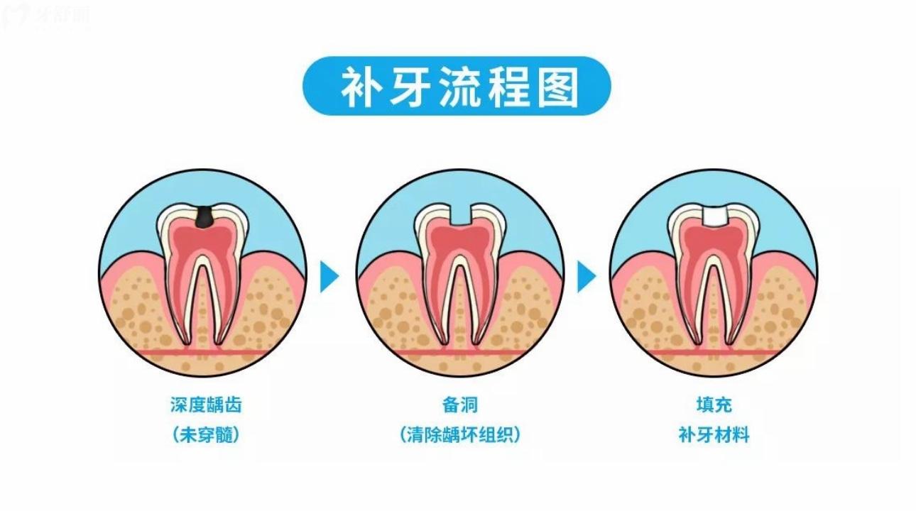 聽說廣州廣大口腔佛山醫(yī)院口碑不錯 有沒有親診牙友評價(jià)