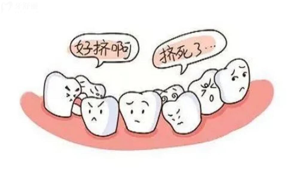 矯正牙齒拔掉的牙什么時候能把空缺填上去?需要注意什么