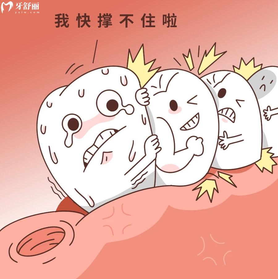 不注意護(hù)理，將近2W的種植牙失敗了后悔一輩子