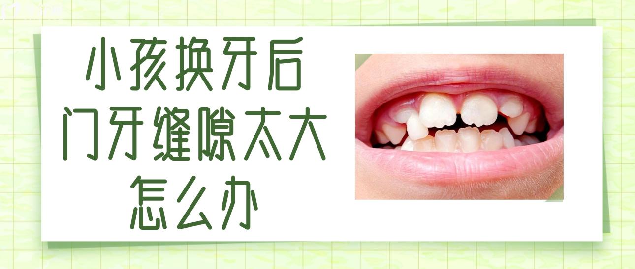 小孩換牙后門牙縫隙太大怎么辦？一般都是什么原因引起的