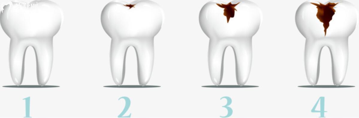 大牙爛了只剩一點(diǎn)空殼了可以拔掉嗎？怎么辦還有必要保留嗎