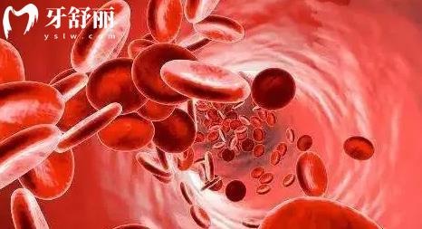 為什么患有糖尿病的人不能拔牙？還有哪些人也不能拔牙？