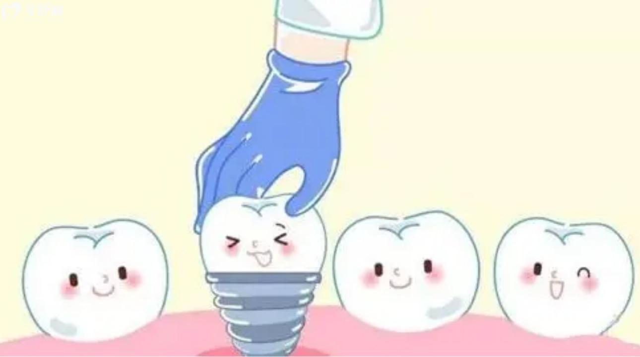 美國皓圣Hiossen種植體
