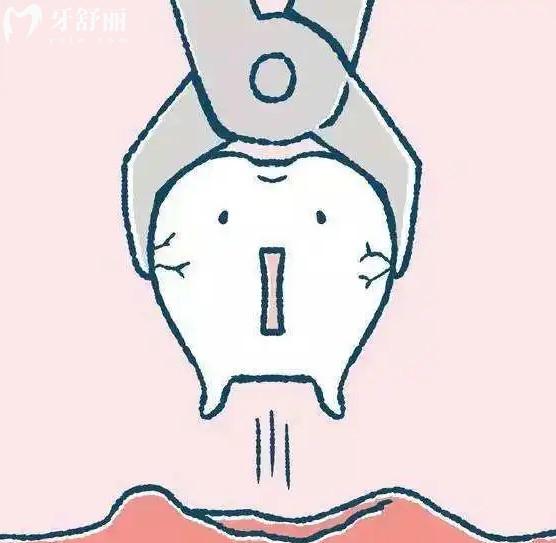 拔智齒