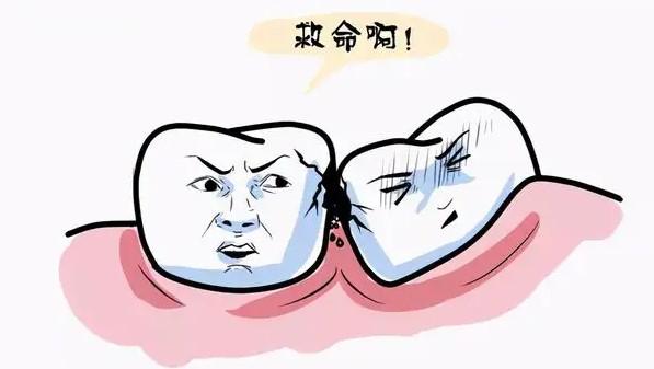 拔智齒