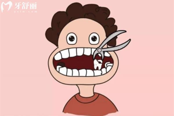 松動(dòng)牙拔除卡通圖
