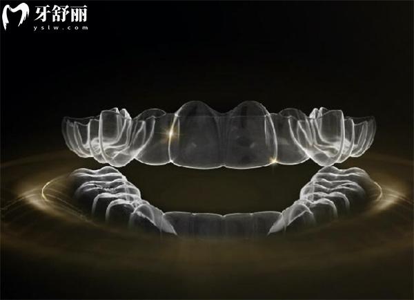 時(shí)代天使隱形矯正