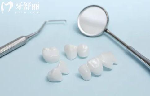 撫州英倫口腔醫(yī)院烤瓷、全瓷牙冠價(jià)格是多少